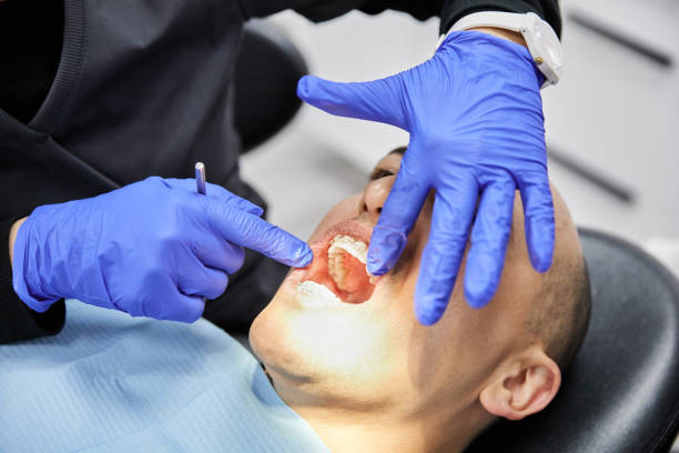 Best Chipped Tooth Repair Near Me  in Level Plains, AL